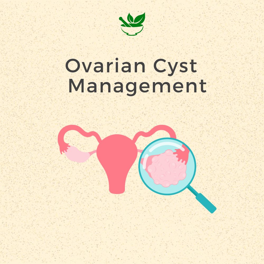 Behandeling van ovariumcysten Ayurvedisch management 30 dagenpakket